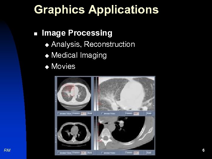 Graphics Applications n Image Processing Analysis, Reconstruction u Medical Imaging u Movies u RM