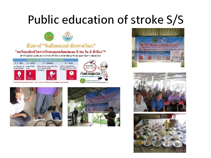 Public education of stroke S/S 