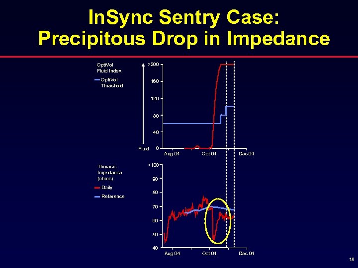 In. Sync Sentry Case: Precipitous Drop in Impedance Opti. Vol Fluid Index >200 Opti.