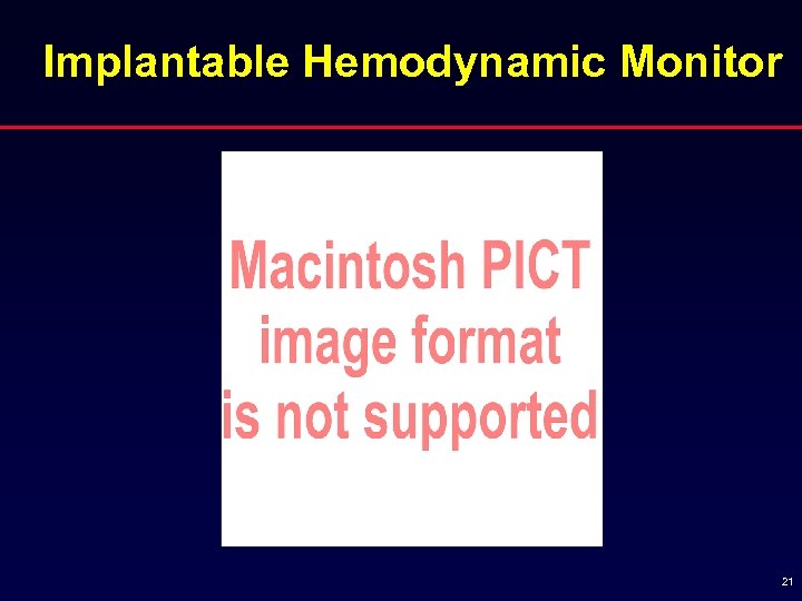 Implantable Hemodynamic Monitor 21 