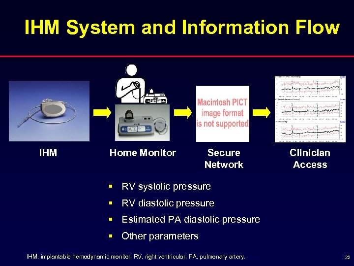 IHM System and Information Flow IHM Home Monitor Secure Network Clinician Access § RV