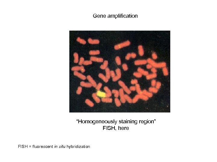 Gene amplification “Homogeneously staining region” FISH, here FISH = fluorescent in situ hybridization 