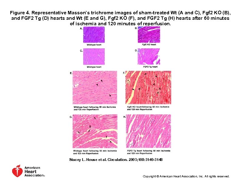 Figure 4. Representative Masson’s trichrome images of sham-treated Wt (A and C), Fgf 2