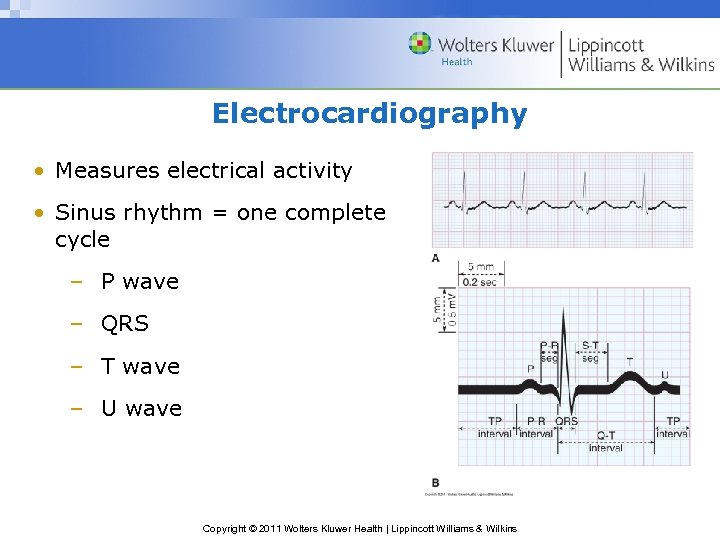 Electrocardiography • Measures electrical activity • Sinus rhythm = one complete cycle – P