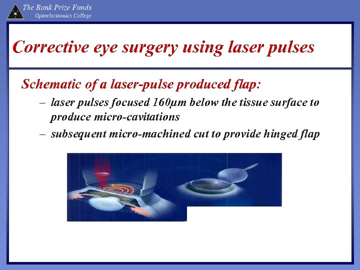 Corrective eye surgery using laser pulses Schematic of a laser-pulse produced flap: – laser