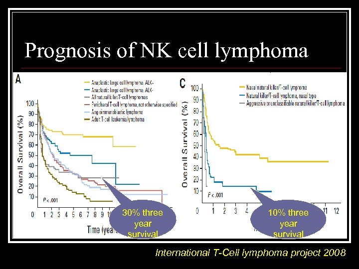 Prognosis of NK cell lymphoma 30% three year survival 10% three year survival International