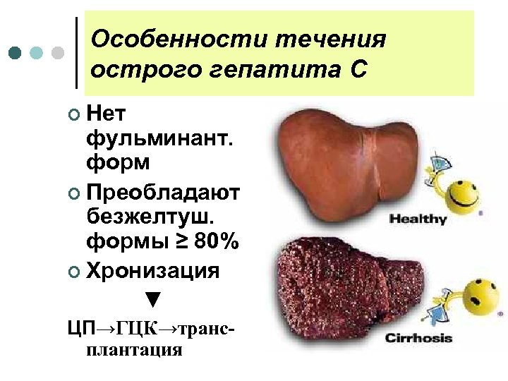 Особенности течения острого гепатита С ¢ Нет фульминант. форм ¢ Преобладают безжелтуш. формы ≥