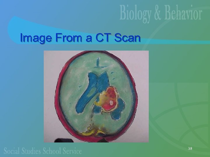 Image From a CT Scan 38 