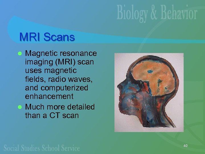 MRI Scans Magnetic resonance imaging (MRI) scan uses magnetic fields, radio waves, and computerized