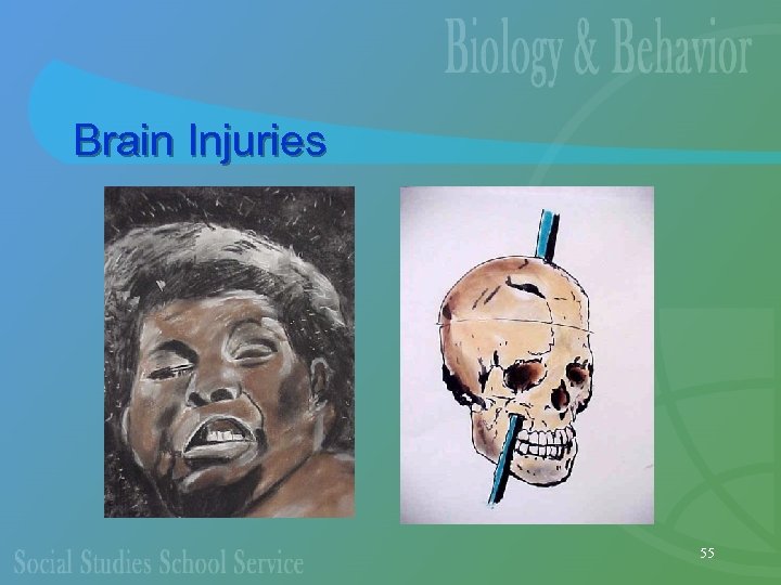Brain Injuries 55 