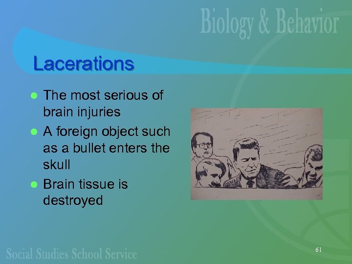 Lacerations The most serious of brain injuries l A foreign object such as a