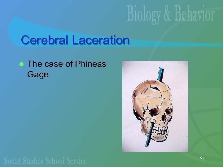 Cerebral Laceration l The case of Phineas Gage 63 