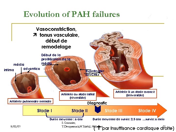 Evolution of PAH failures Vasoconstriction, tonus vasculaire, début de remodelage média adventice intima Début