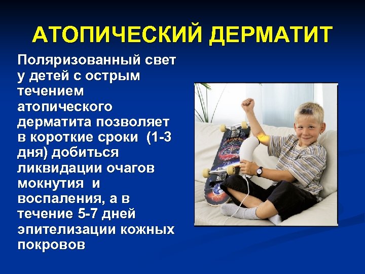 АТОПИЧЕСКИЙ ДЕРМАТИТ Поляризованный свет у детей с острым течением атопического дерматита позволяет в короткие
