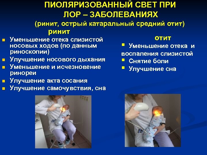 ПИОЛЯРИЗОВАННЫЙ СВЕТ ПРИ ЛОР – ЗАБОЛЕВАНИЯХ (ринит, острый катаральный средний отит) ринит n n