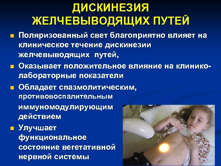 ДИСКИНЕЗИЯ ЖЕЛЧЕВЫВОДЯЩИХ ПУТЕЙ n n n Поляризованный свет благоприятно влияет на клиническое течение дискинезии