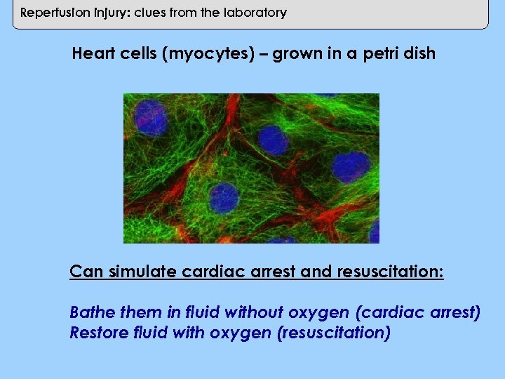 Reperfusion injury: clues from the laboratory Heart cells (myocytes) – grown in a petri