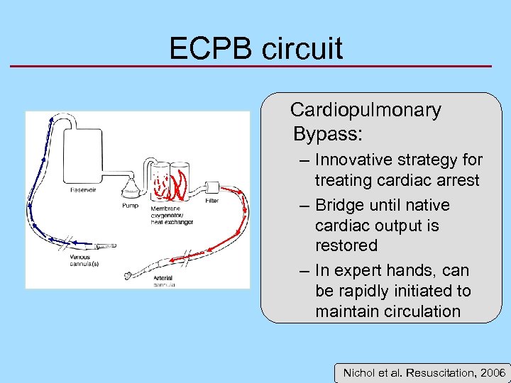 ECPB circuit Cardiopulmonary Bypass: – Innovative strategy for treating cardiac arrest – Bridge until