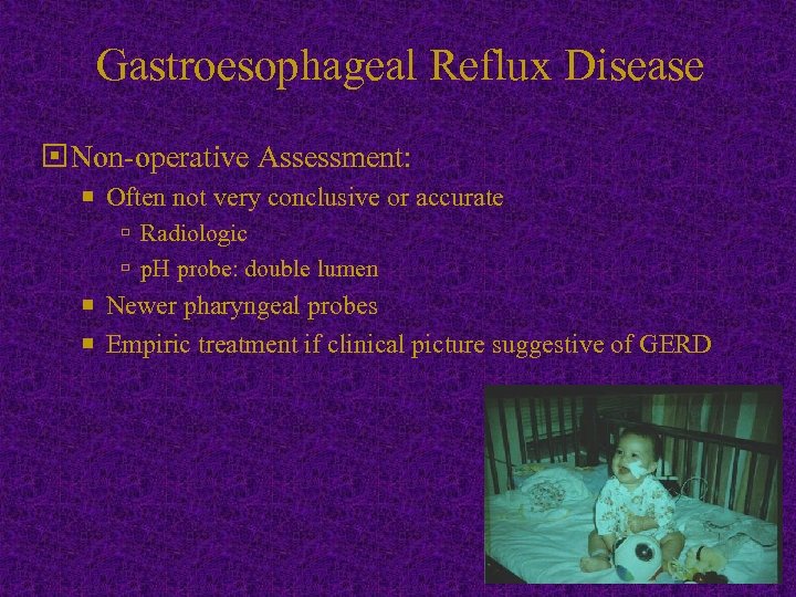 Gastroesophageal Reflux Disease Non-operative Assessment: Often not very conclusive or accurate Radiologic p. H