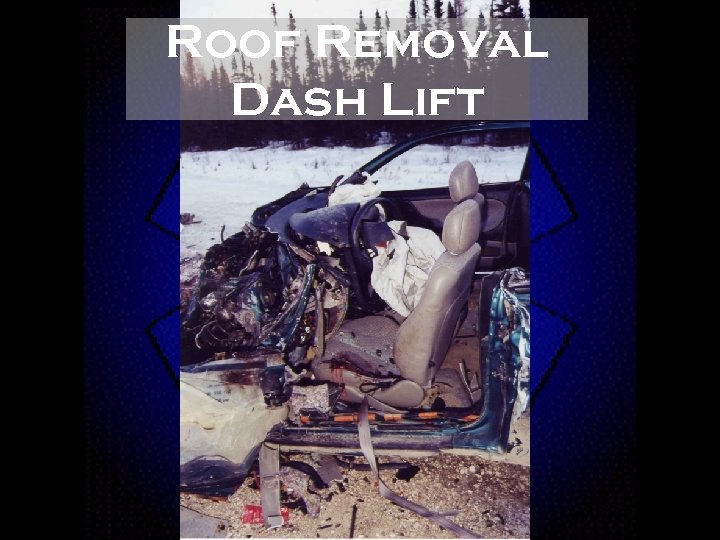 Roof Removal Dash Lift 