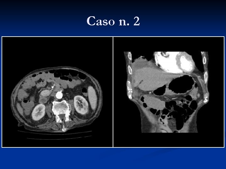 Caso n. 2 