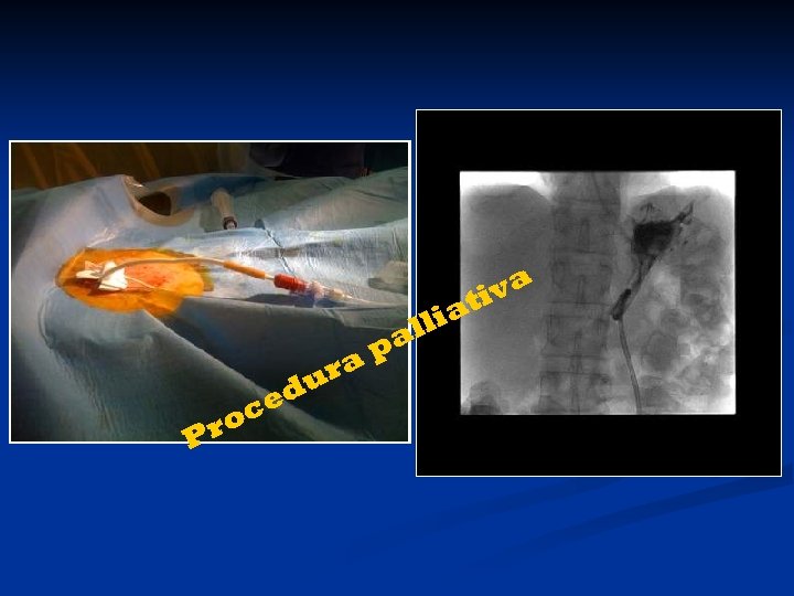 a iva t lli pa a ur d Pr ce o 