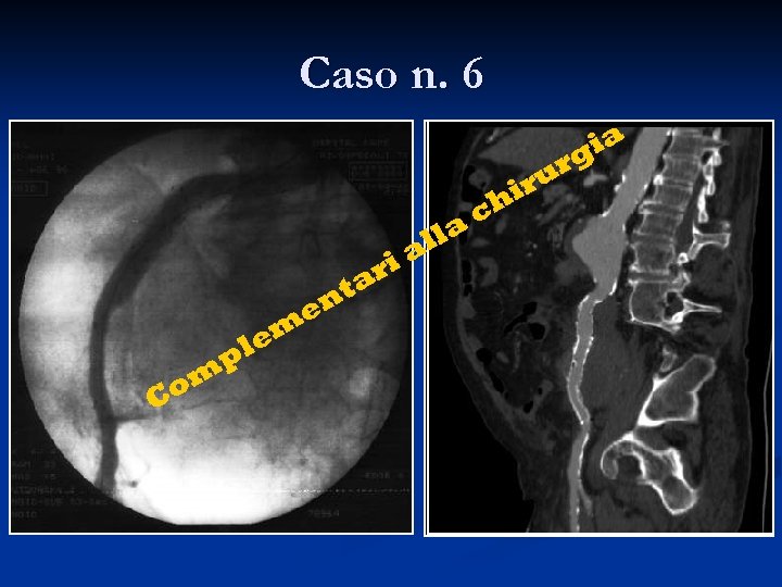 Caso n. 6 ri a nt e om C em pl lla a ch