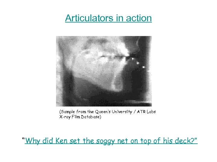 Articulators in action (Sample from the Queen’s University / ATR Labs X-ray Film Database)