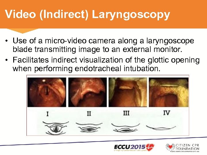 Video Laryngoscopy in Cardiac Arrest Colby J Rowe