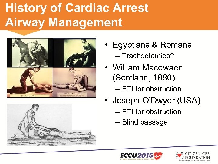 History of Cardiac Arrest Airway Management • Egyptians & Romans – Tracheotomies? • William