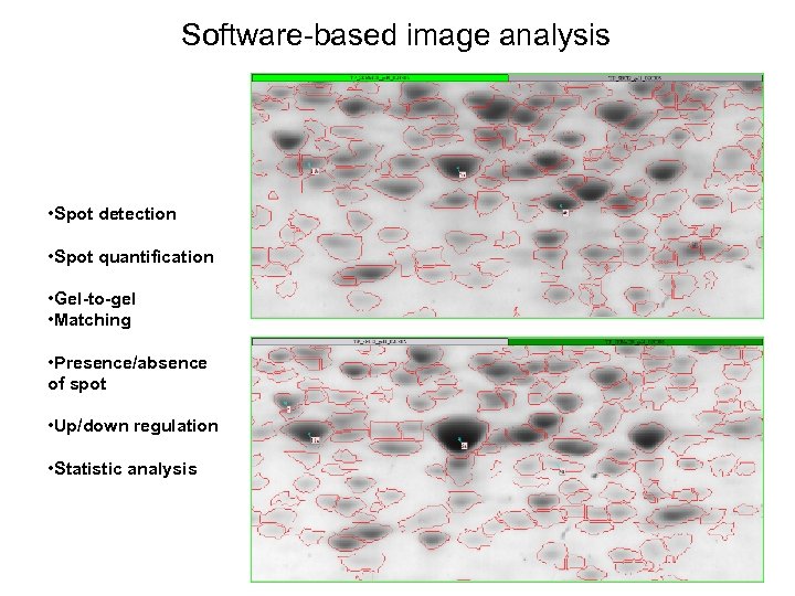 Software-based image analysis • Spot detection • Spot quantification • Gel-to-gel • Matching •