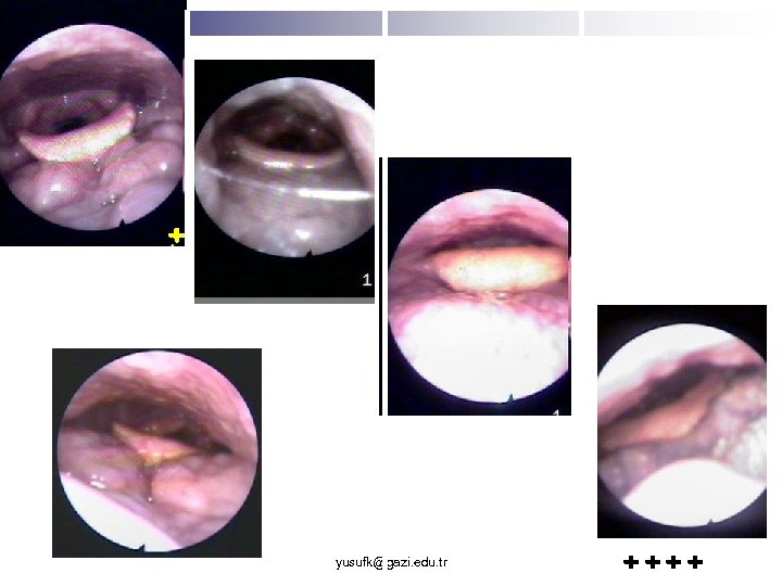 + yusufk@gazi. edu. tr ++++ 