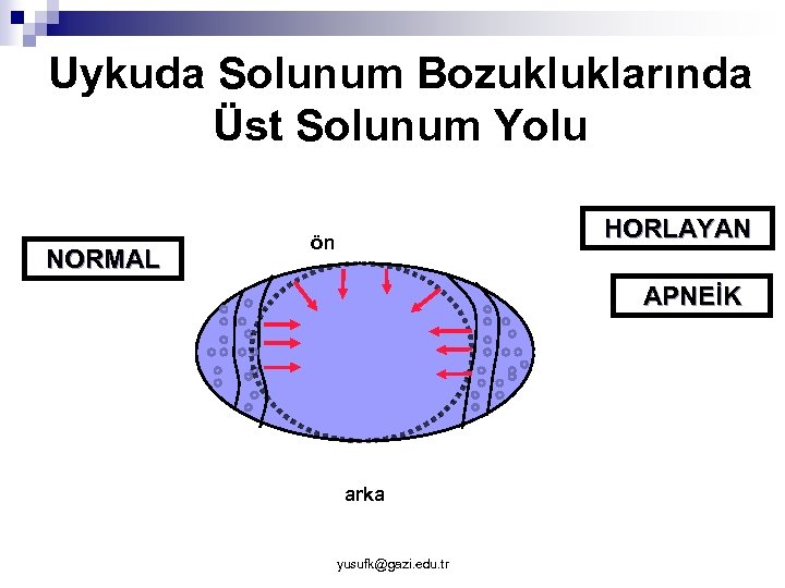 Uykuda Solunum Bozukluklarında Üst Solunum Yolu NORMAL HORLAYAN ön APNEİK arka yusufk@gazi. edu. tr