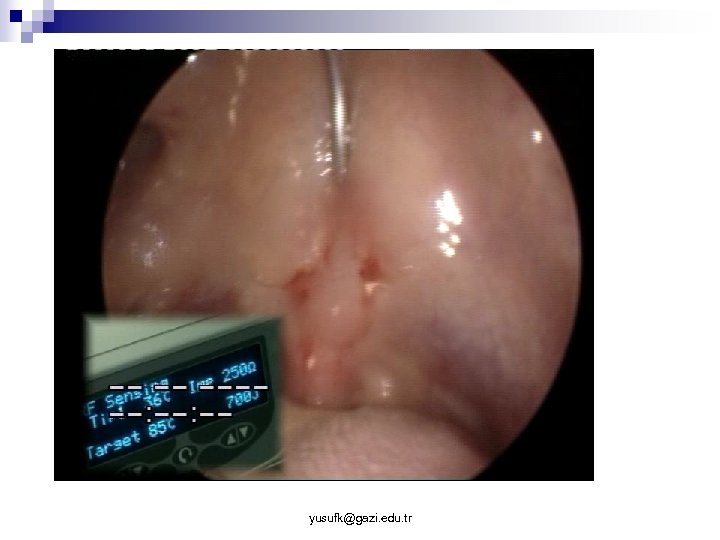 yusufk@gazi. edu. tr 