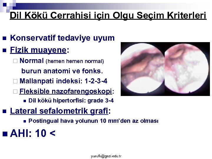Dil Kökü Cerrahisi için Olgu Seçim Kriterleri n n Konservatif tedaviye uyum Fizik muayene: