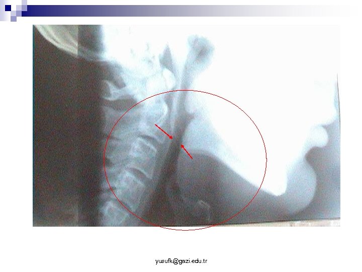 yusufk@gazi. edu. tr 