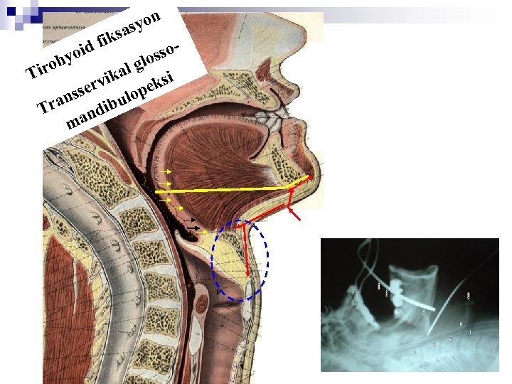 n syo a iks id f o sso y glo roh l Ti i