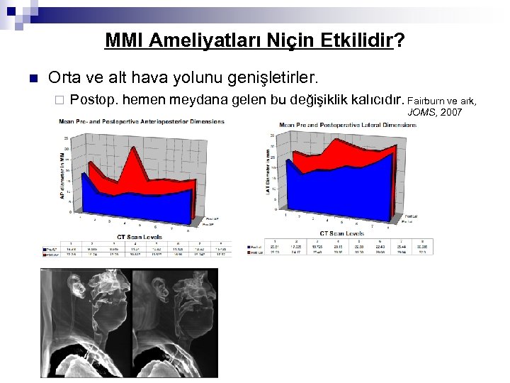 MMI Ameliyatları Niçin Etkilidir? n Orta ve alt hava yolunu genişletirler. ¨ Postop. hemen