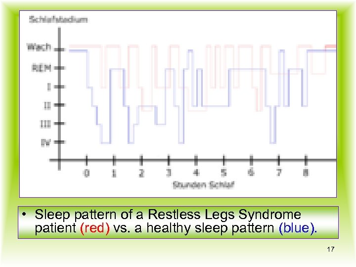  • Sleep pattern of a Restless Legs Syndrome patient (red) vs. a healthy