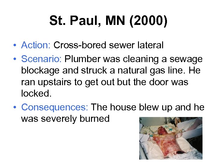 St. Paul, MN (2000) • Action: Cross-bored sewer lateral • Scenario: Plumber was cleaning