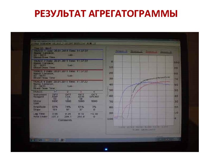 РЕЗУЛЬТАТ АГРЕГАТОГРАММЫ 
