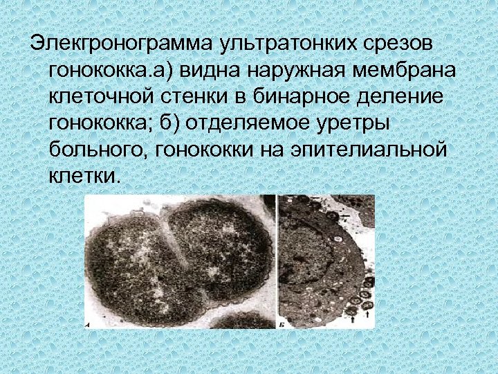 Элекгронограмма ультратонких срезов гонококка. а) видна наружная мембрана клеточной стенки в бинарное деление гонококка;