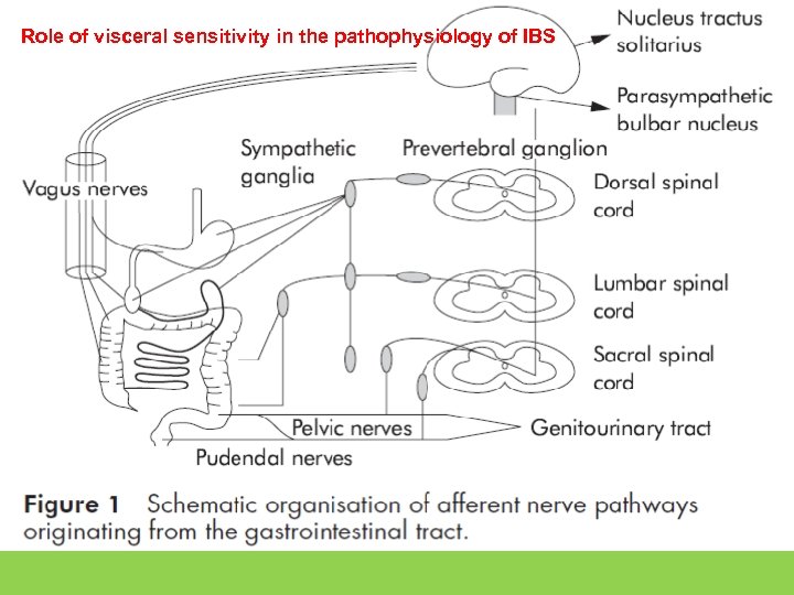 Role of visceral sensitivity in the pathophysiology of IBS View larger version: • In