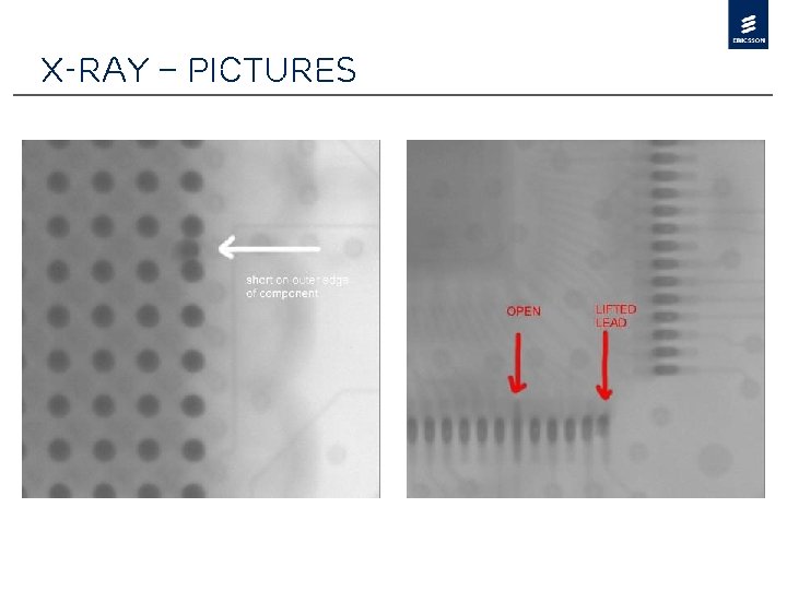 X-Ray – Pictures 