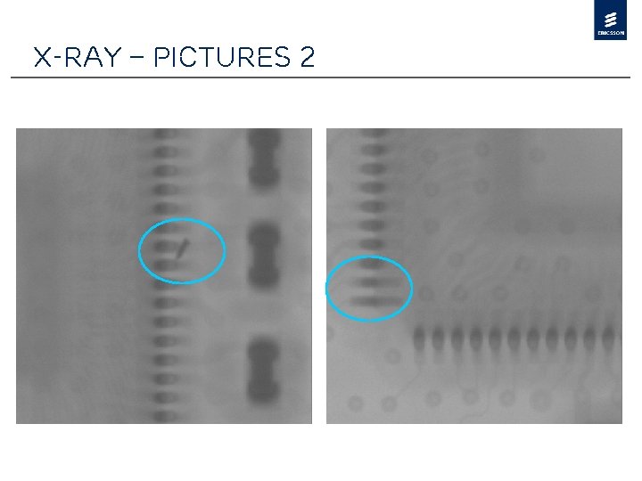 X-Ray – Pictures 2 