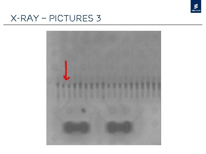 X-Ray – Pictures 3 