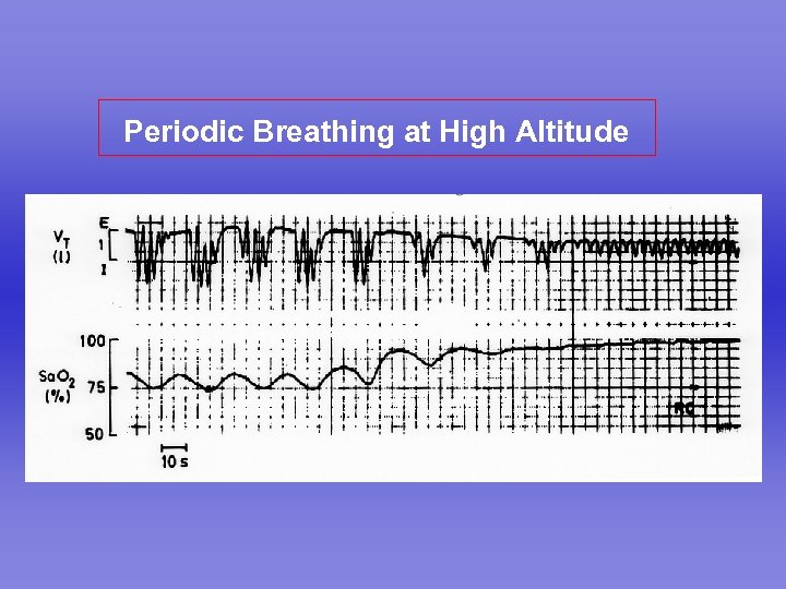 Periodic Breathing at High Altitude 