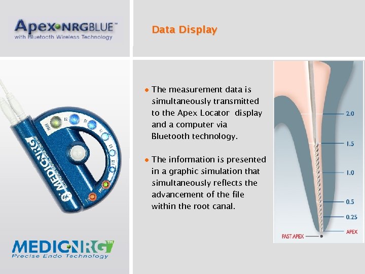 Data Display ● The measurement data is simultaneously transmitted to the Apex Locator display