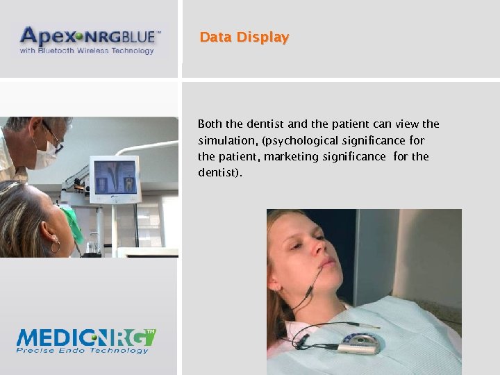 Data Display Both the dentist and the patient can view the simulation, (psychological significance