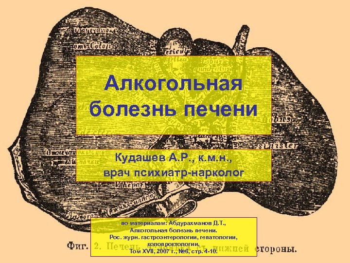 Алкогольная болезнь печени Кудашев А. Р. , к. м. н. , врач психиатр-нарколог по